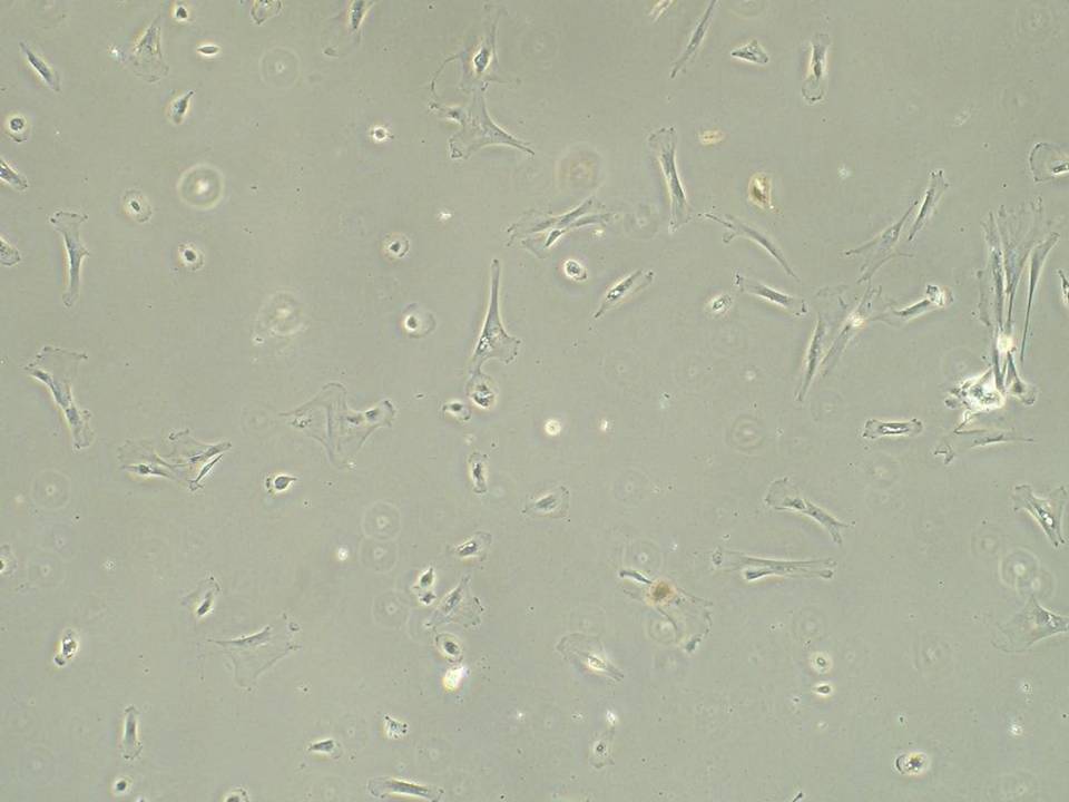 NEPA21 / Primary - Human Uterine Cervical Fibroblast - Viability 65 per cent